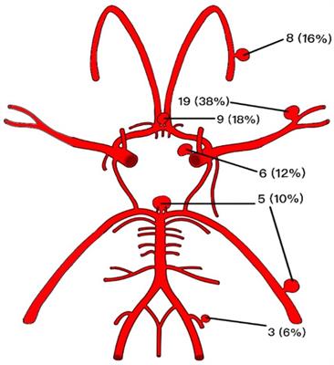 Technical success, procedural safety, and efficacy of the Silk Vista Baby in the treatment of cerebral aneurysms over a mid-to-long-term follow-up